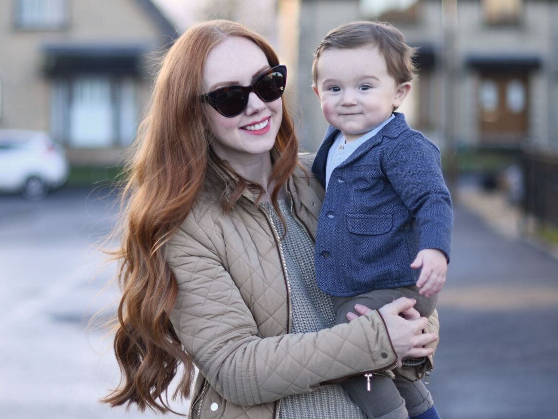 after gum contouring